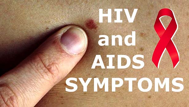 எய்ட்ஸ் எனும் உயிர் கொல்லி நோய் - விழிப்புணர்வு தேவை 2 AIDS. thinatamil |