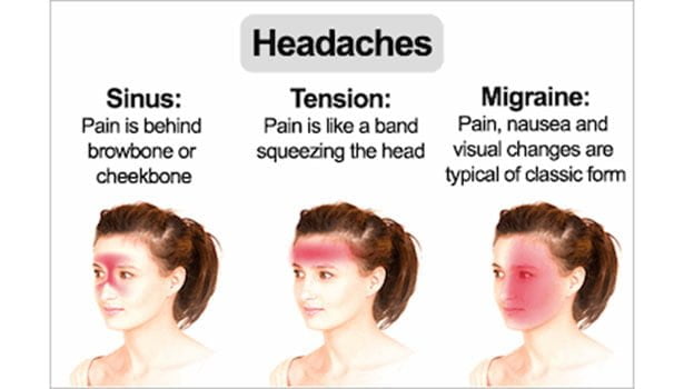 மைக்ரேன் தலைவலி வருவதற்கான காரணங்கள்.. 3 Micron headache thinatamil |