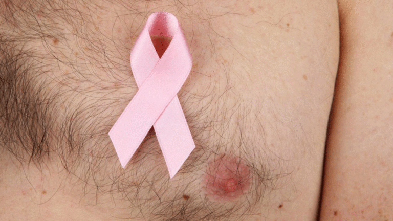 male-breast-cancer_thinatamil
